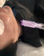 Cool plasma training .Learn how to perform the cool plasma , with different electrodes that can  (3)