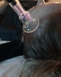 Cool plasma training .Learn how to perform the cool plasma , with different electrodes that can  (2)